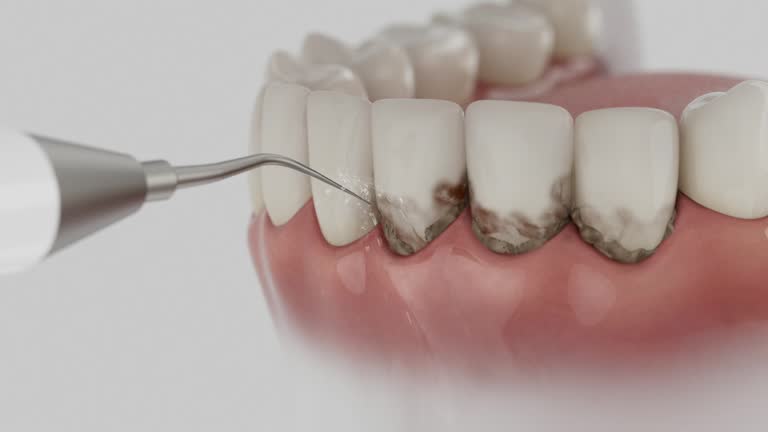 Trusted Tooth Extraction service in Windham, OH - Dentist Open Now